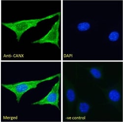 Calnexin Antibody, Novus Biologicals 0.1mg; Unlabeled:Antibodies, Polyclonal