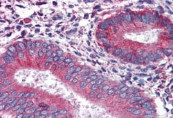 Calnexin Antibody, Novus Biologicals 0.1mg; Unlabeled:Antibodies, Polyclonal
