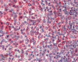 Calnexin Antibody, Novus Biologicals 0.2 mg; Unconjugated:Antibodies, Polyclonal