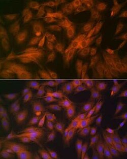 Calpain 1 Rabbit anti-Human, Mouse, Rat, Clone: 10E6O5, Novus Biologicals 100 &mu;g | Buy Online | Novus Biologicals | Fisher Scientific