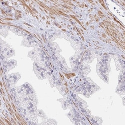 Calpain 11 Antibody, Novus Biologicals:Antibodies:Primary Antibodies