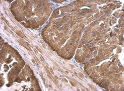 anti-Calpain 2, Polyclonal, Novus Biologicals 0.1mL; Unlabeled:Antibodies,