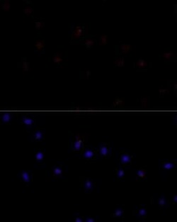 Calpain 7 Rabbit anti-Human, Mouse, Rat, Polyclonal, Novus Biologicals 100 &mu;g | Buy Online | Novus Biologicals | Fisher Scientific