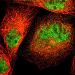 Calpain S1 Antibody, Novus Biologicals 25 &mu;L; Unlabeled:Antibodies,