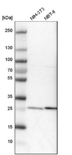 Calpain S1 Antibody, Novus Biologicals 25 &mu;L; Unlabeled:Antibodies,