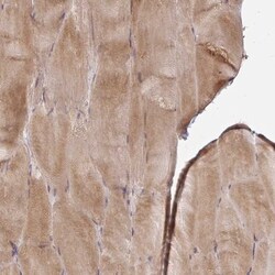 Calpastatin Antibody, Novus Biologicals 0.1mL; Unlabeled:Antibodies, Polyclonal