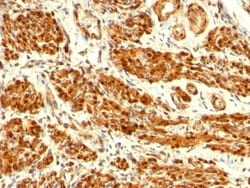 Calponin 1 Antibody (CNN1/832), Novus Biologicals 0.2mg; Unlabeled:Antibodies,
