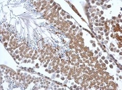 Calreticulin-2/CALR3 Antibody, Novus Biologicals 100 &mu;L | Buy Online | Novus Biologicals | Fisher Scientific