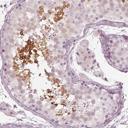 Calreticulin-2/CALR3 Antibody, Novus Biologicals 0.1mL; Unlabeled:Antibodies,