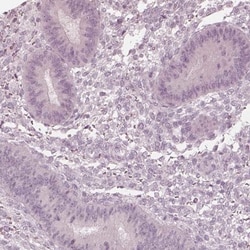 Calreticulin-2/CALR3 Antibody, Novus Biologicals 0.1mL; Unlabeled:Antibodies,