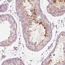 Calreticulin-2/CALR3 Antibody, Novus Biologicals 0.1mL; Unlabeled:Antibodies,