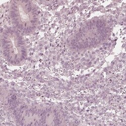 Calreticulin-2/CALR3 Antibody, Novus Biologicals:Antibodies:Primary Antibodies