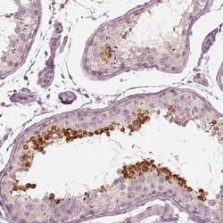 Calreticulin-2/CALR3 Antibody, Novus Biologicals:Antibodies:Primary Antibodies