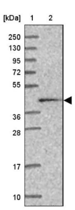 Calreticulin-2/CALR3 Antibody, Novus Biologicals:Antibodies:Primary Antibodies