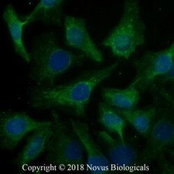 Calreticulin Antibody (1G6A7) - BSA Free, Novus Biologicals:Antibodies:Primary