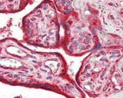Calreticulin Antibody (1G6A7) - BSA Free, Novus Biologicals:Antibodies:Primary