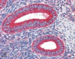 Calreticulin Antibody (FMC 75), Novus Biologicals 0.025mg; Unlabeled:Antibodies,