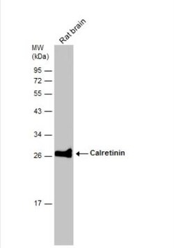 Calretinin Antibody, Novus Biologicals 0.1mL; Unlabeled:Antibodies