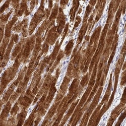 Calsequestrin 2 Antibody, Novus Biologicals:Antibodies:Primary Antibodies