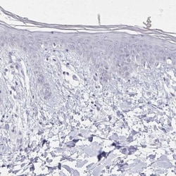 Calsequestrin 2 Antibody, Novus Biologicals:Antibodies:Primary Antibodies