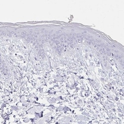 Calsequestrin 2 Antibody, Novus Biologicals:Antikörper:Primärantikörper