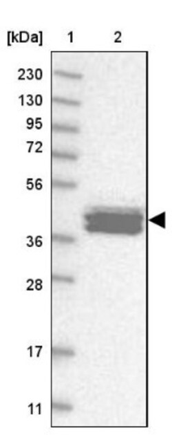 Calsequestrin 2 Antibody, Novus Biologicals:Antibodies:Primary Antibodies