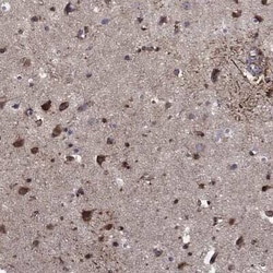 Calsyntenin-1 Rabbit anti-Human, Polyclonal, Novus Biologicals:Antibodies:Primary