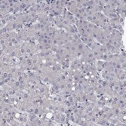 Calsyntenin-1 Rabbit anti-Human, Polyclonal, Novus Biologicals:Antibodies:Primary