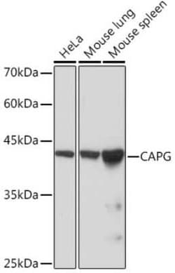 CapG Rabbit anti-Human, Mouse, Rat, Clone: 5V9G1, Novus Biologicals:Antibodies:Primary