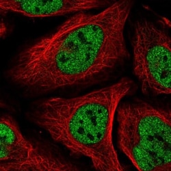 Capicua Antibody, Novus Biologicals 0.1mL; Unlabeled:Antibodies, Polyclonal