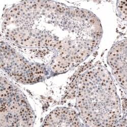 Capicua Antibody, Novus Biologicals 0.1mL; Unlabeled:Antibodies, Polyclonal