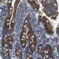 Carbohydrate Sulfotransferase 10/CHST10 Antibody, Novus Biologicals 25