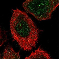 Carbohydrate Sulfotransferase 15/CHST15 Antibody, Novus Biologicals:Antibodies:Primary