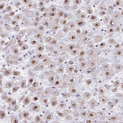 Carbohydrate Sulfotransferase 3/CHST3 Antibody, Novus Biologicals 25 &mu;L | Buy Online | Novus Biologicals | Fisher Scientific