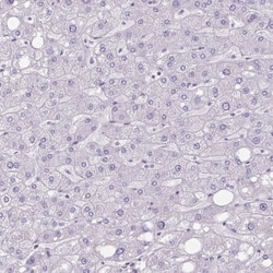 Carbohydrate Sulfotransferase 3/CHST3 Antibody, Novus Biologicals 25 &mu;L | Buy Online | Novus Biologicals | Fisher Scientific