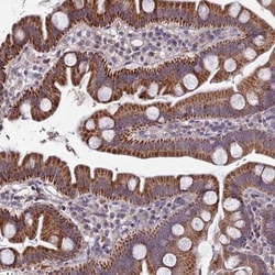 Carbohydrate Sulfotransferase 5/CHST5 Antibody, Novus Biologicals 0.1mL;