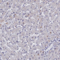 Carbohydrate Sulfotransferase 5/CHST5 Antibody, Novus Biologicals 0.1mL;