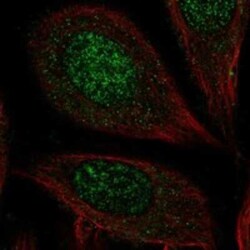 Carbohydrate Sulfotransferase 7/CHST7 Rabbit anti-Human, Polyclonal, Novus