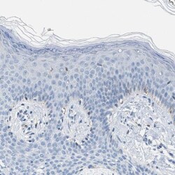 Carbonic Anhydrase III/CA3 Antibody, Novus Biologicals 0.1mL; Unlabeled:Antibodies,