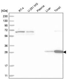 Carbonic Anhydrase III/CA3 Antibody, Novus Biologicals 0.1mL; Unlabeled:Antibodies,