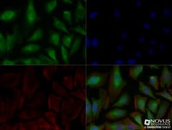 Carbonic Anhydrase IX/CA9 Antibody (2D3) - BSA Free, Novus Biologicals:Antibodies:Primary