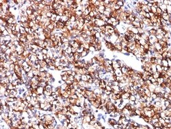 Carbonic Anhydrase IX/CA9 Antibody (CA9/781), Novus Biologicals 0.2mg;