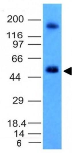 Carbonic Anhydrase IX/CA9 Antibody (CA9/781), Novus Biologicals 0.2mg;