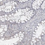 Thumbnail_Carbonic Anhydrase VI Antibody, Novus Biologicals:Antibodies:Primary Antibodies