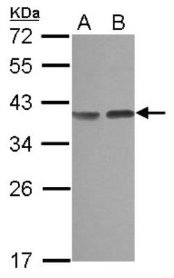 Carbonic Anhydrase VIII/CA8 Antibody, Novus Biologicals 0.1mL; Unlabeled:Antibodies,