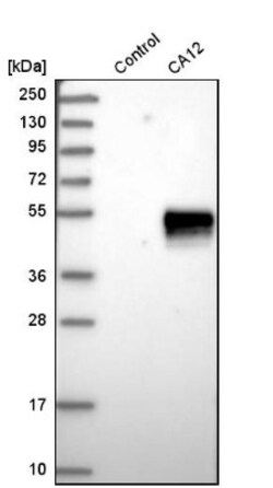Carbonic Anhydrase XII/CA12 Antibody, Novus Biologicals:Antibodies:Primary