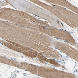 Carbonic Anhydrase XIV/CA14 Antibody, Novus Biologicals 25 &mu;L; Unlabeled:Antibodies,