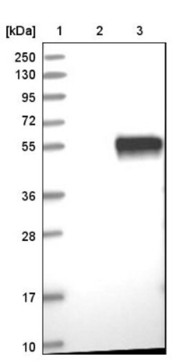 Carbonic Anhydrase XIV/CA14 Antibody, Novus Biologicals 25 &mu;L; Unlabeled:Antibodies,