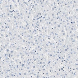 Carboxyl Ester Lipase/CEL Antibody, Novus Biologicals 25 &mu;L; Unlabeled:Antibodies,