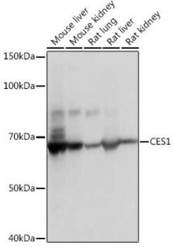 Carboxylesterase 1/CES1 Rabbit anti-Human, Mouse, Rat, Clone: 7C9R6, Novus